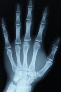 X ray